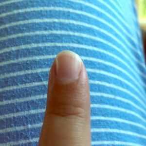 tip of fingernail once it grows and breaks off